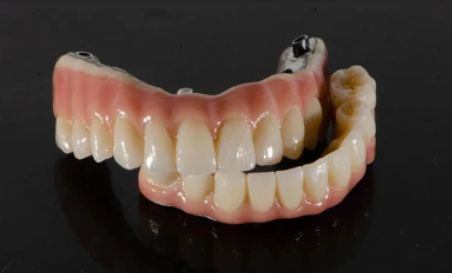 Prothèse 5