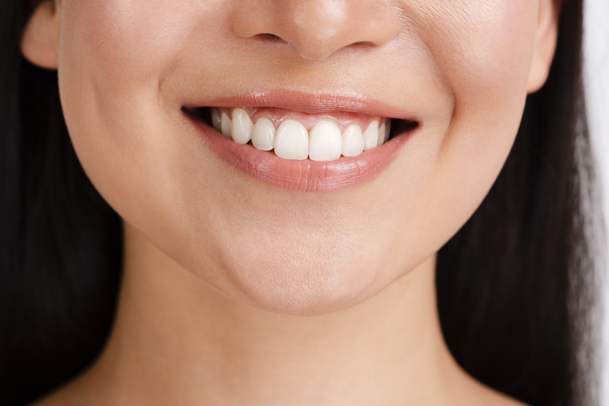 Sourire Femme 2